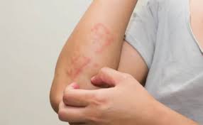 Top Skin Sexual Allergy Disease Specialist Banner Image